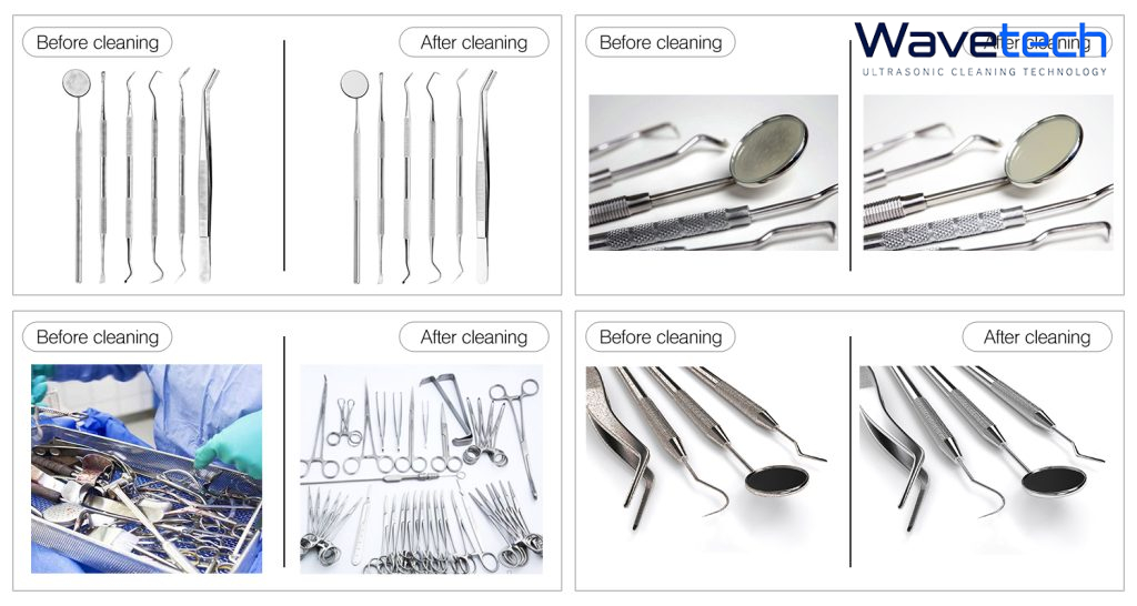 Hiệu quả của rửa dụng cụ nha khoa bằng sóng siêu âm